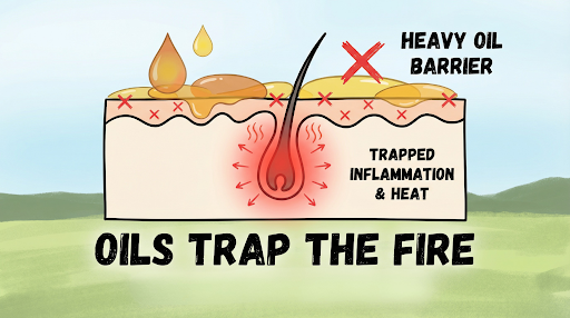 Diagram showing how a heavy oil barrier traps inflammation and heat around the follicle