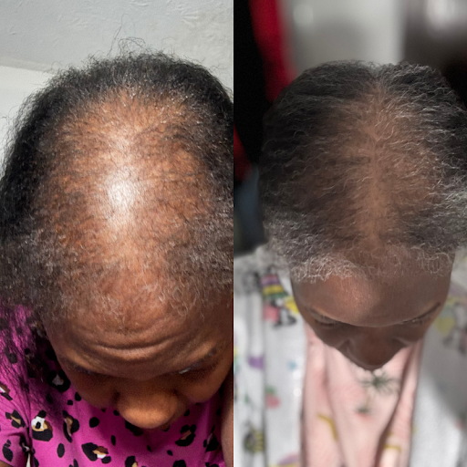 Bridgette's part before and after, showing the thinning area filled in