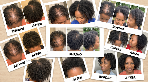 Collage of before, during and after photos from other women who used the ampoule